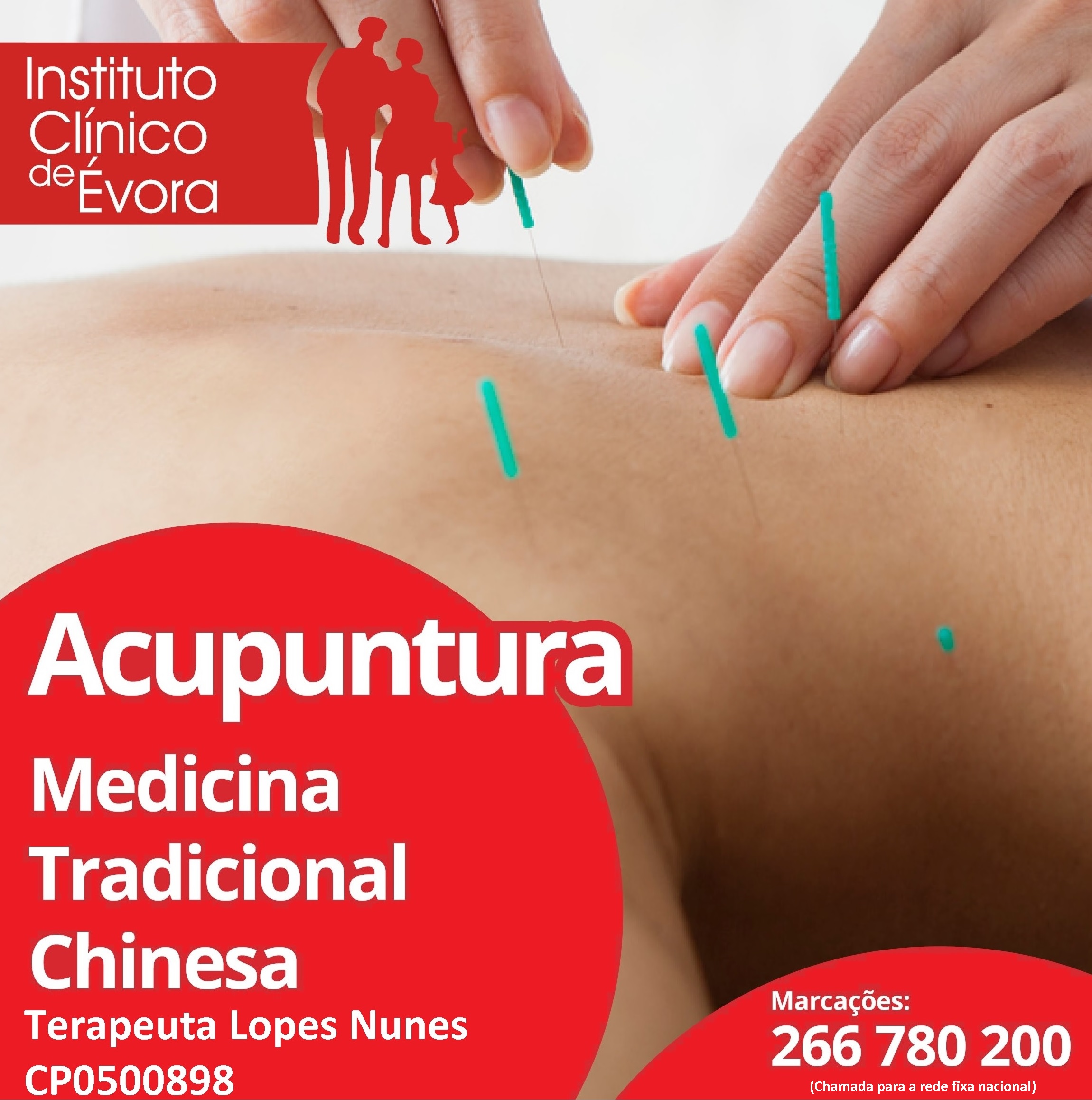 Acupuntura